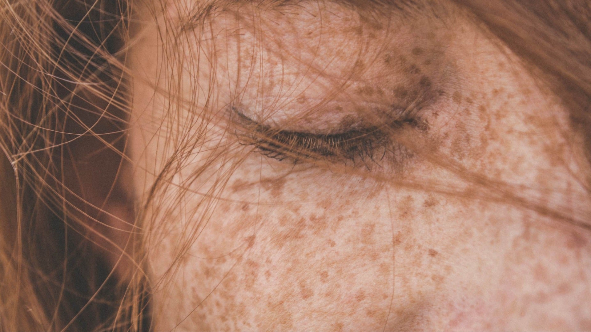 Femme avec taches de rousseurs rousses
